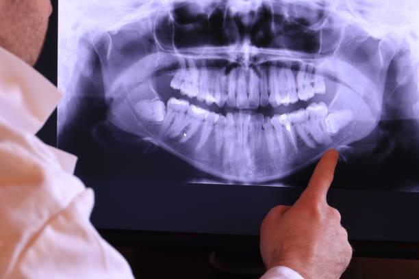 Best Emergency Dentist for Lost Fillings or Crowns in Richmond, VA