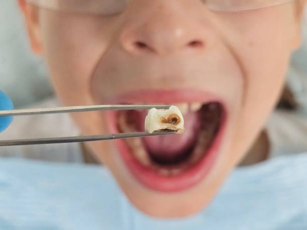 Best Pediatric Emergency Dentist in Richmond, VA